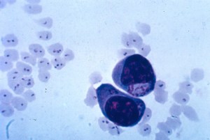 Theileria schizonts (inside cells with nucleai) and infected erythrocytes.