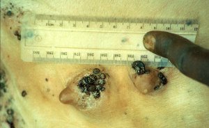 Amblyomma cohaerens (gold) and A. variegatum (orange) tick infestation.